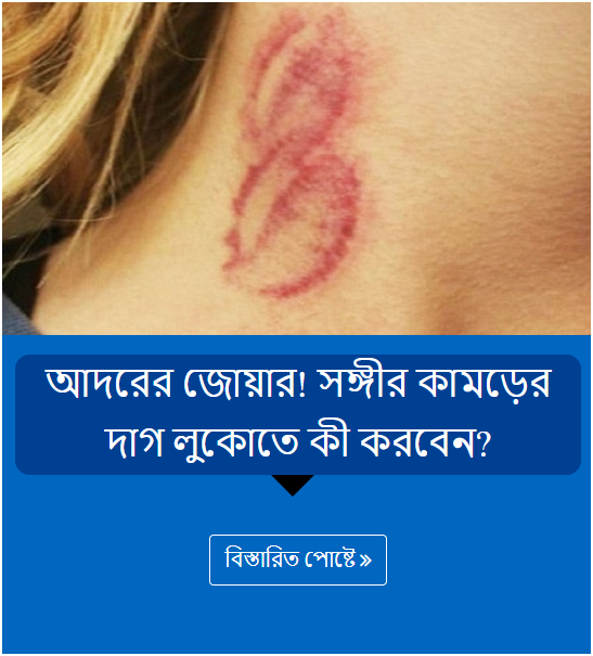 আদরের জোয়ার! সঙ্গীর কামড়ের দাগ লুকোতে কী করবেন?