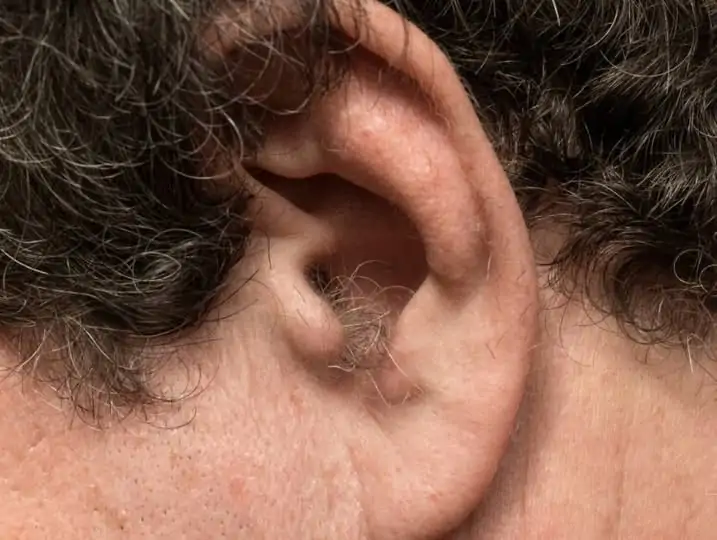 কানে চুল গজানো কিসের ই’ঙ্গিত? বিশেষজ্ঞরা যা বলছেন!