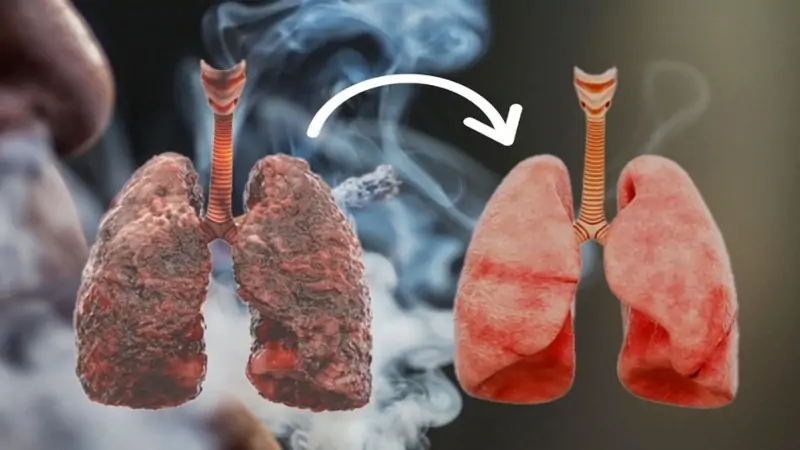 অতিরিক্ত ধূমপানে ফুসফুস ক্ষতিগ্রস্ত! নিয়মিত খান এই ৬ খাবার