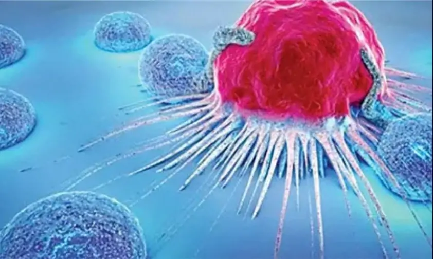 গোপনে ক্যান্সারে ভুগছেন: যে লক্ষণ দেখলে বুঝবেন